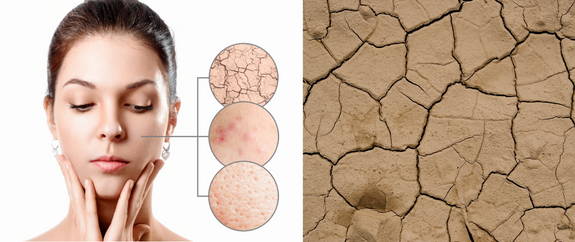 How can you tell if your skin barrier is damaged
