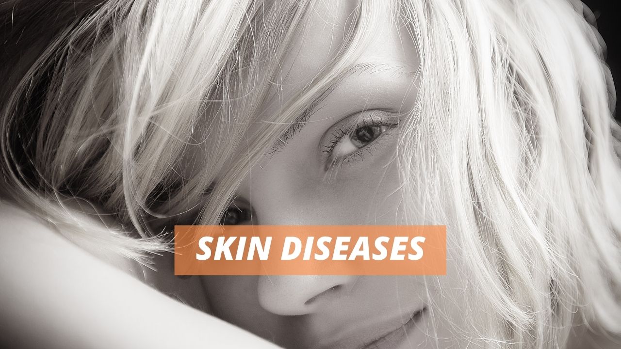 types of skin diseases and its preventions