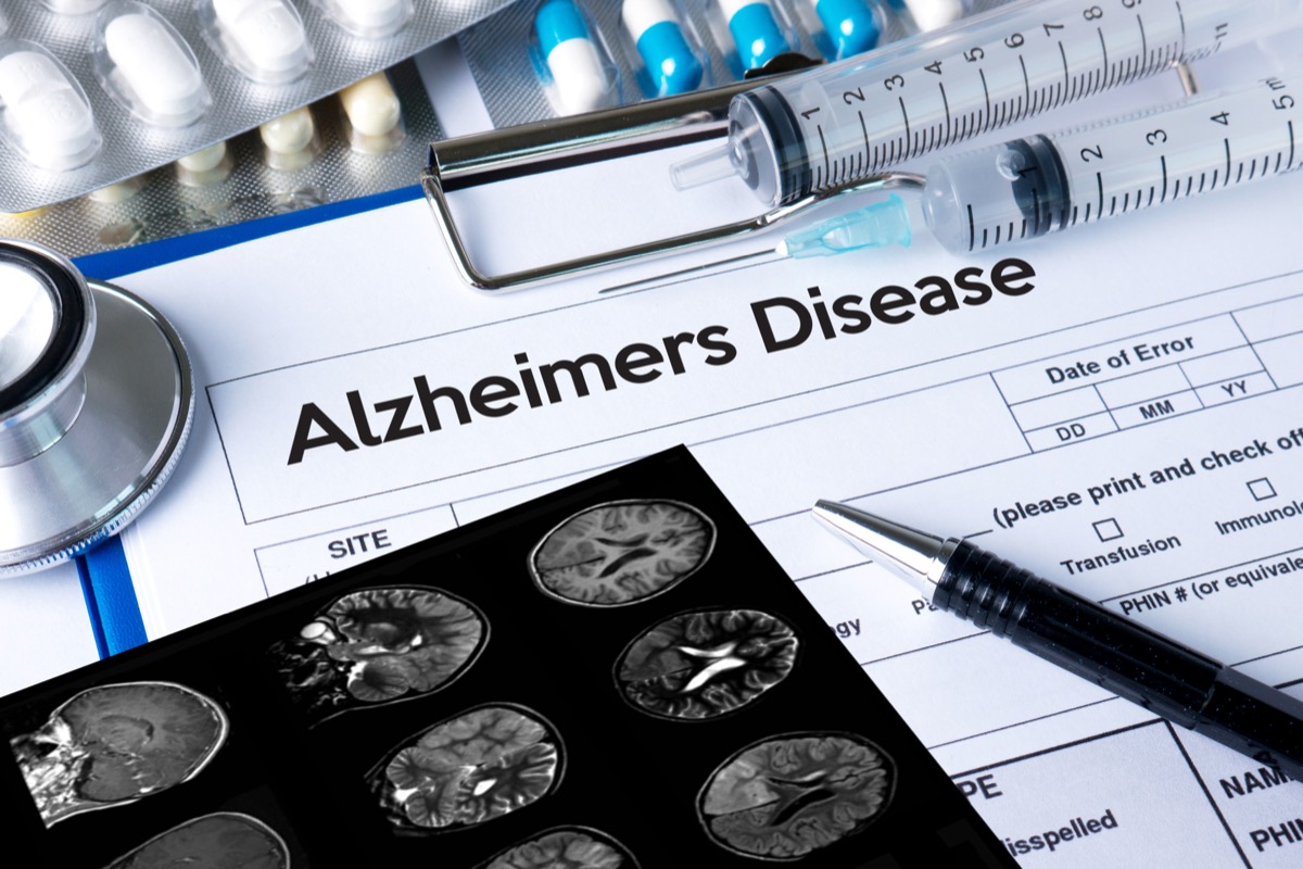 Dementia Signs Usually Appear in This Order