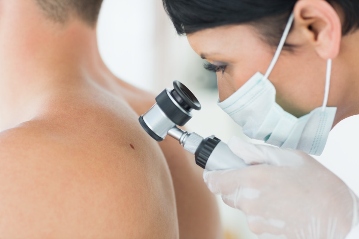 dermatologist examining mole on back of male patient in clinic
