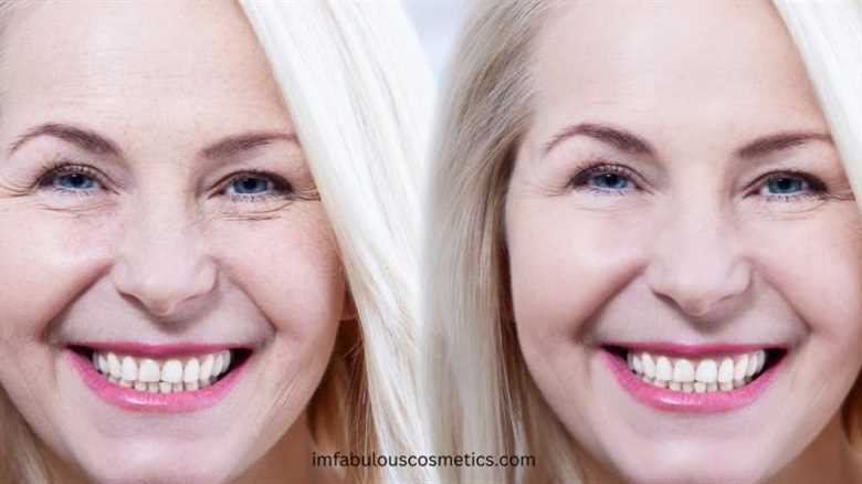 Combatting the Effects of Ozempic Face: A Guide to Restoring Youthful Skin