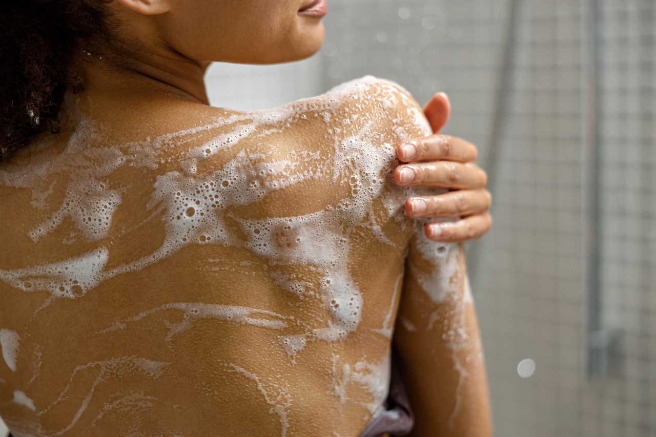 Expert Tips to Prevent Skin Rash After Showering