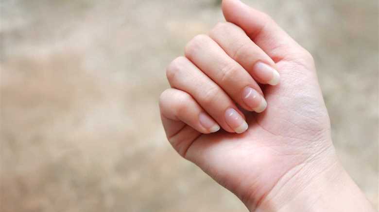 Unveiling the Mystery Behind White Spots on Nails: A Health Indicator